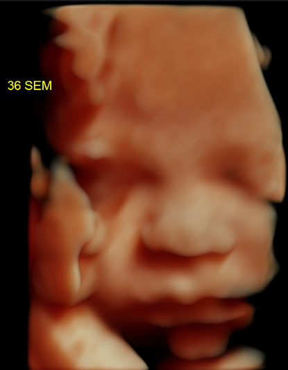 Oso Medalla pronóstico Semana 36 de embarazo | Planeta Mamá