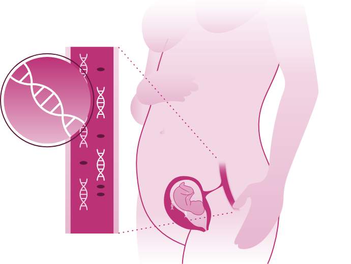 Genesia test prenatal