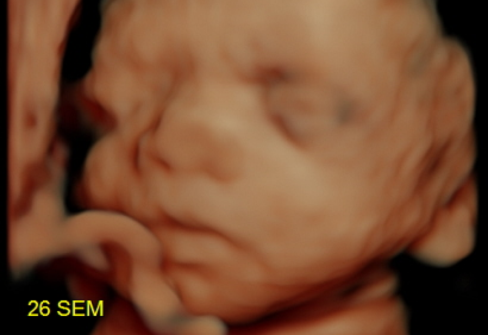 incidente doblado mitología Embarazo: Semana 26 de embarazo | Planeta Mamá