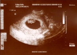 semana 8 de embarazo
